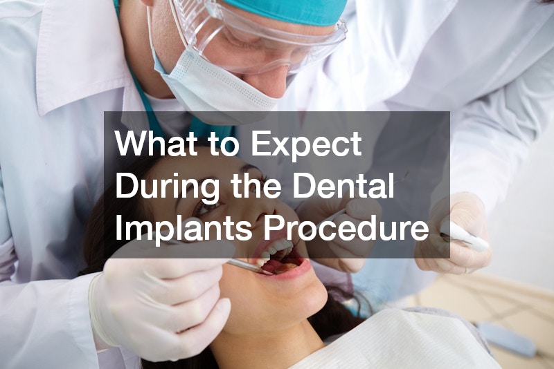 What to Expect During the Dental Implants Procedure