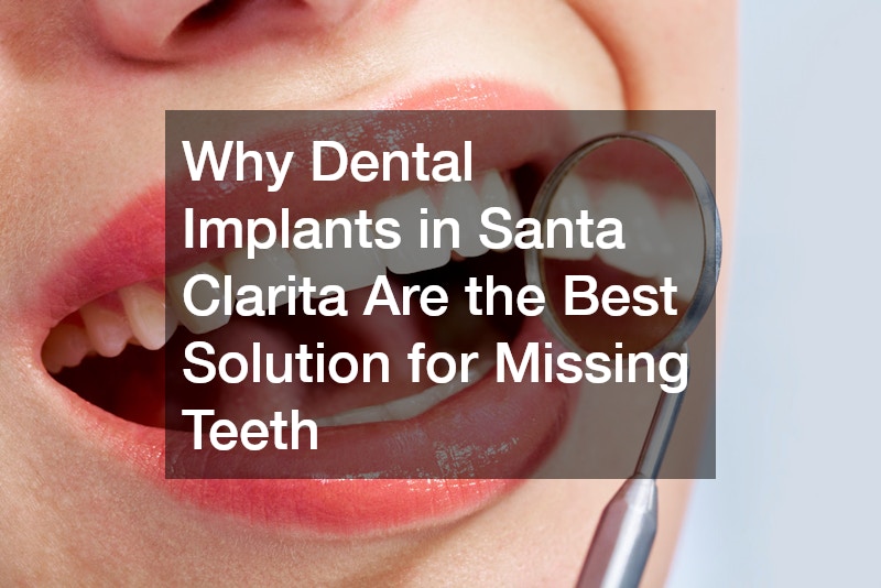 Why Dental Implants in Santa Clarita Are the Best Solution for Missing Teeth